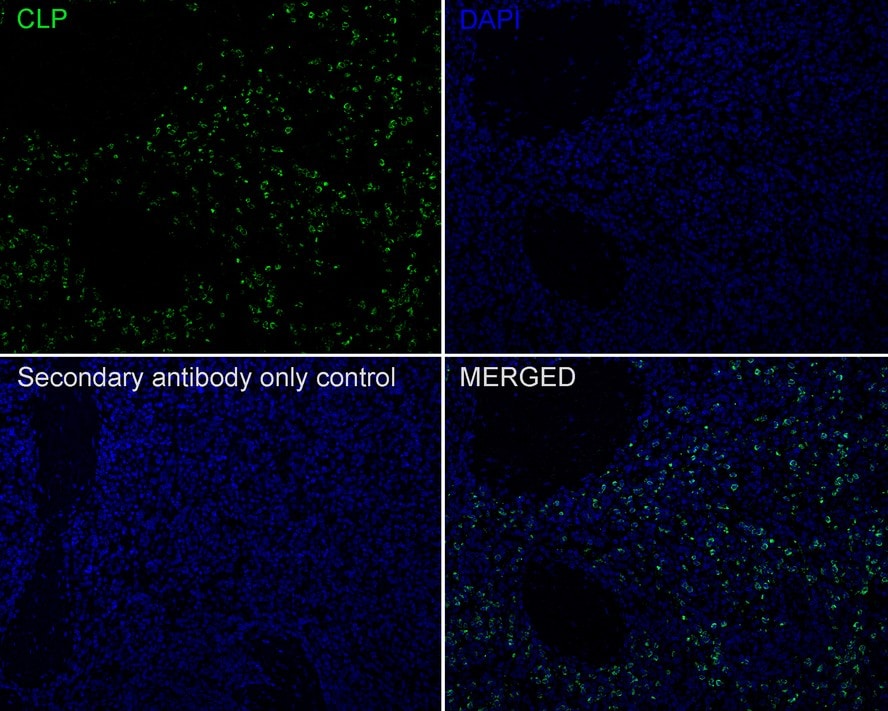 CAMP/LL37/FALL39/Cathelicidin Antibody (PSH01-73)