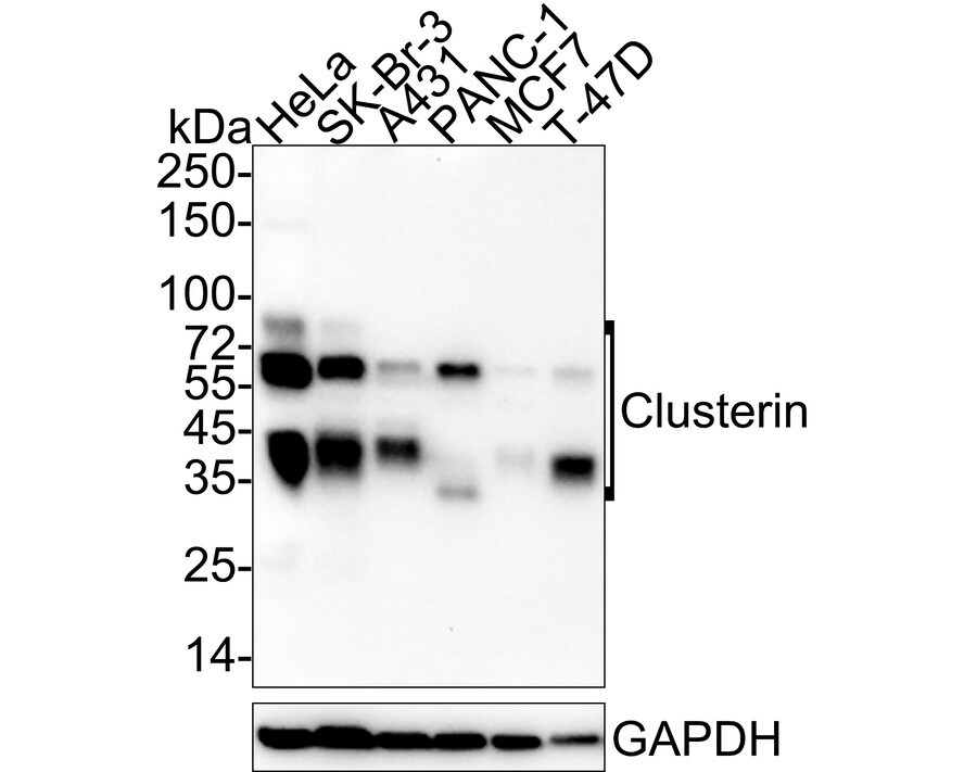 Clusterin/APOJ Antibody (PSH04-33) Western Blot: Clusterin/APOJ Antibody (PSH04-33) [NBP3-32196]