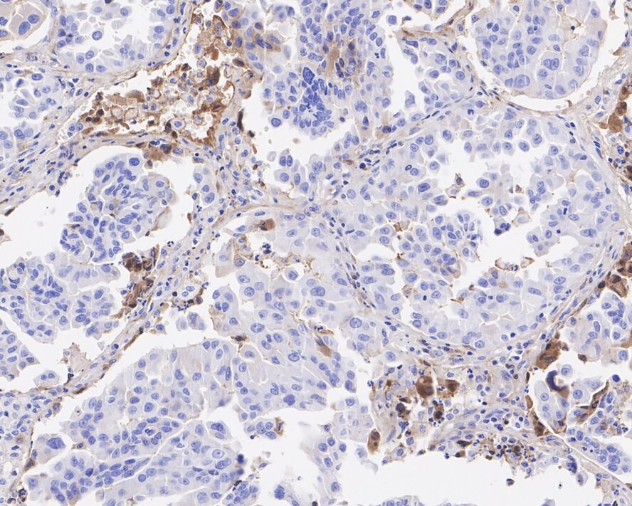 Clusterin/APOJ Antibody (PSH04-33)