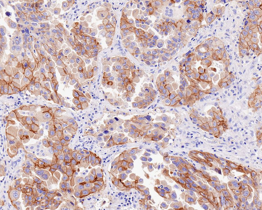 HGFR/c-MET Antibody (PSH0-19)
