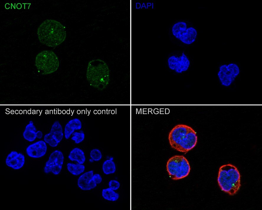 CNOT7 Antibody (PSH02-81)