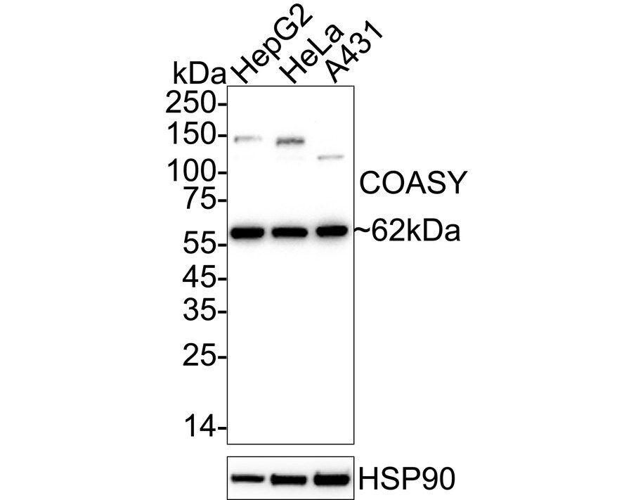 COASY Antibody (JE58-56) Western Blot: COASY Antibody (JE58-56) [NBP3-32203]