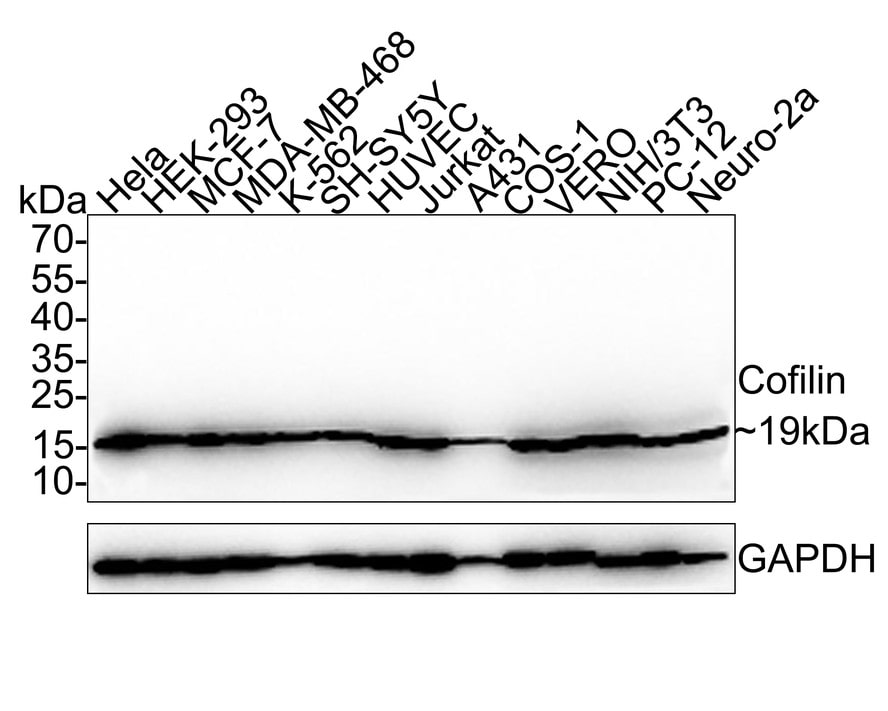 Cofilin Antibody (PSH0-33)
