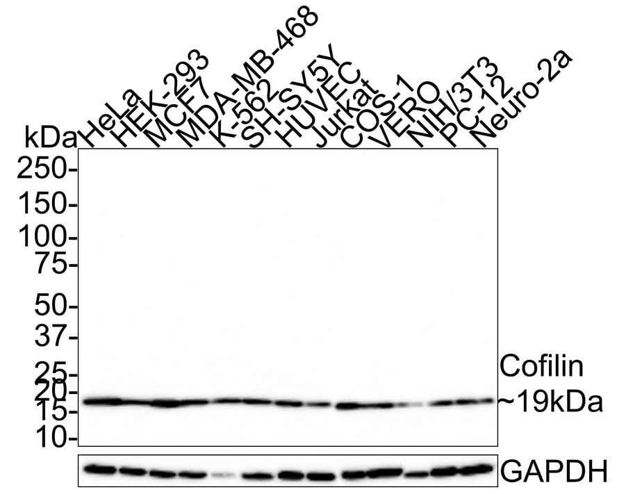 Cofilin Antibody (PSH0-38)
