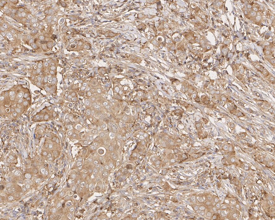 Cofilin Antibody (PSH01-44)