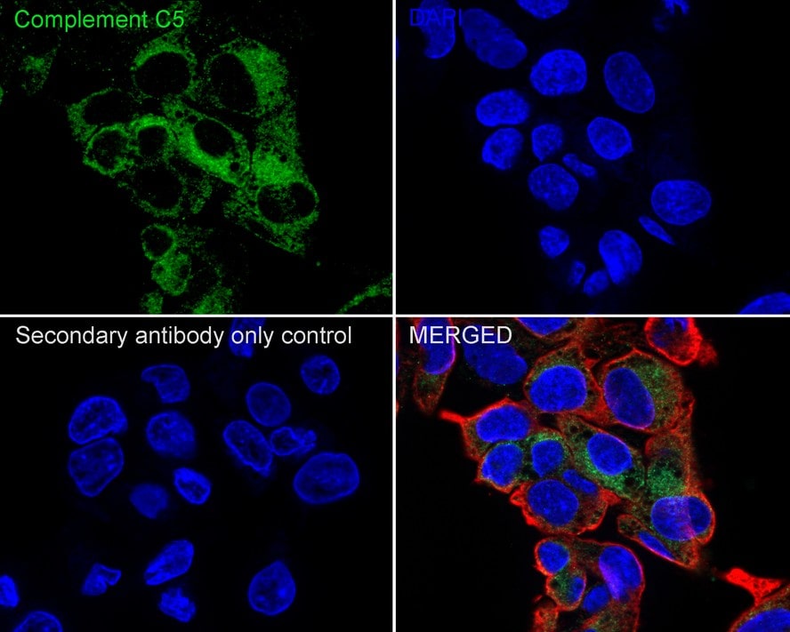 Complement C5 Antibody (PSH04-01)