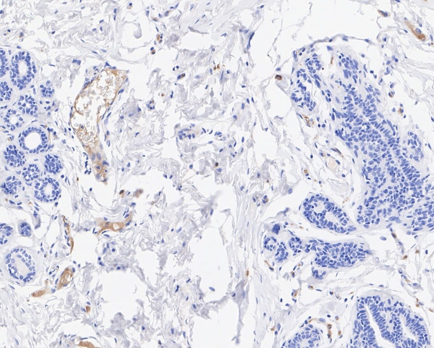 Complement C5 Antibody (PSH04-01)