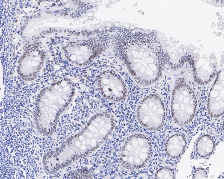 RCOR1/CoREST Antibody (JE35-15)