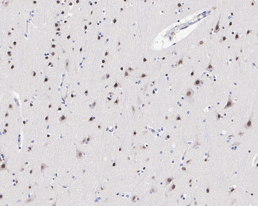 COUP-TF I/NR2F1 Antibody (JE31-95)