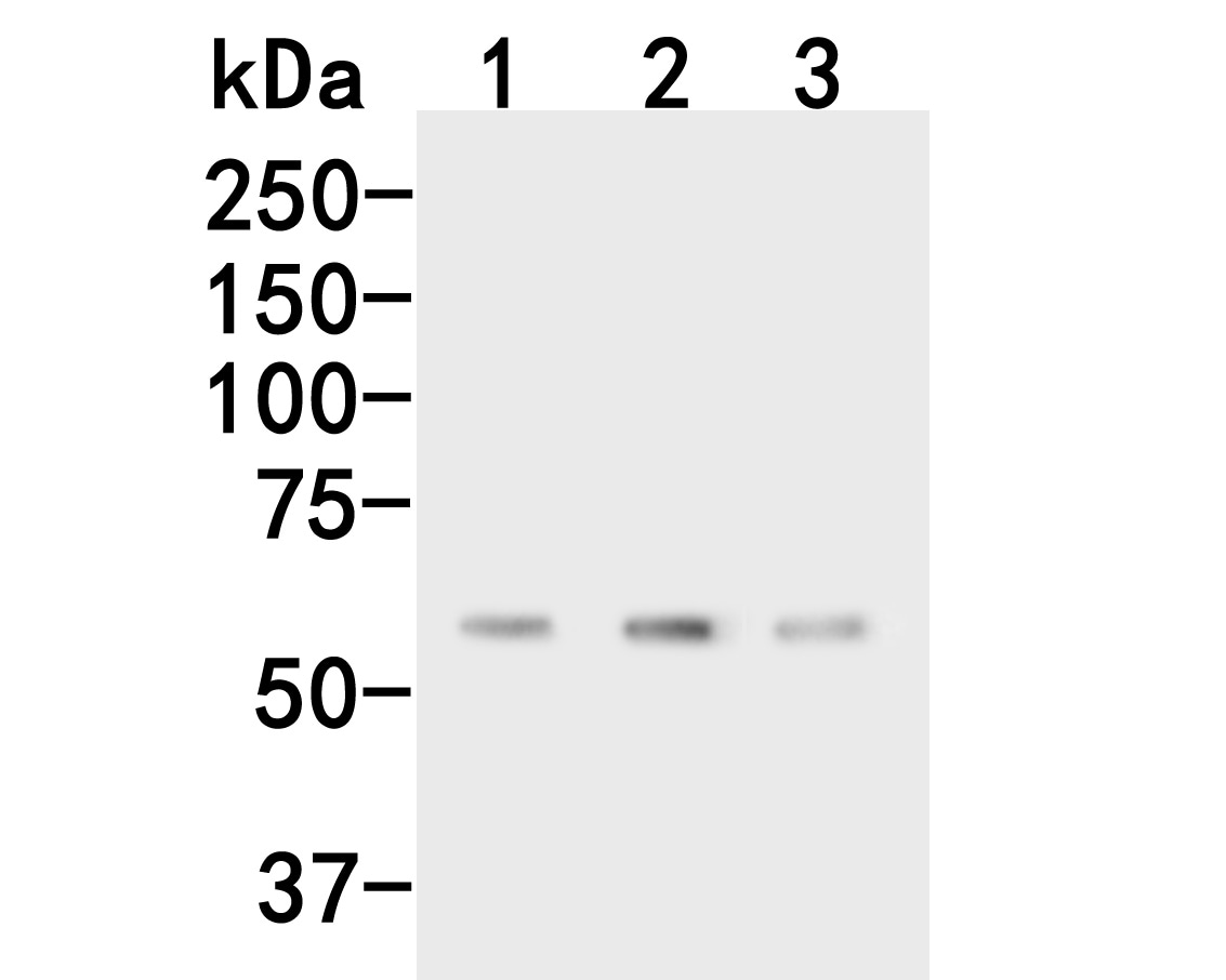 CPN1 Antibody Western Blot: CPN1 Antibody [NBP3-32212]