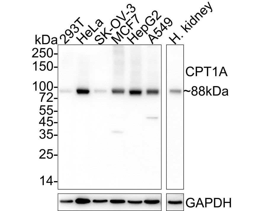 CPT1A Antibody (PSH04-00) Western Blot: CPT1A Antibody (PSH04-00) [NBP3-32213]