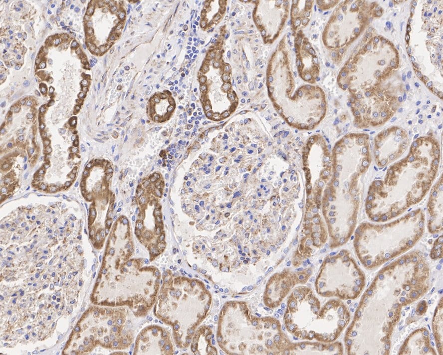CPT1A Antibody (PSH04-00)