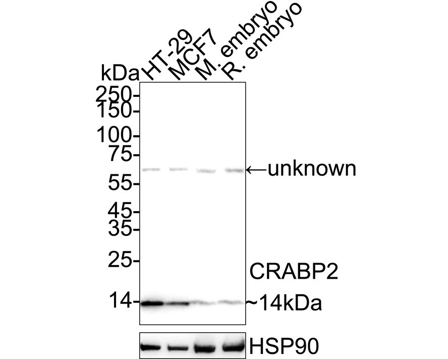 CRABP2 Antibody (JE65-66) Western Blot: CRABP2 Antibody (JE65-66) [NBP3-32214]