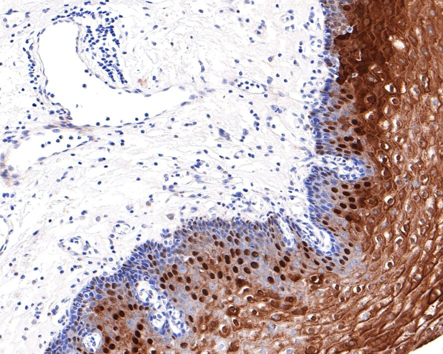 CRABP2 Antibody (JE65-66)