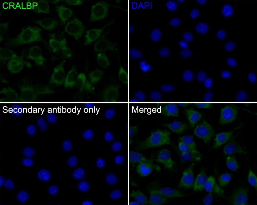 CRALBP Antibody (JE35-09)