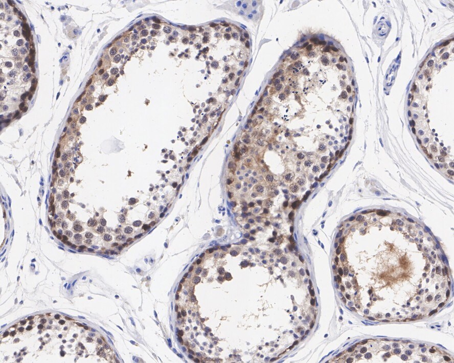 CRBN Antibody (PSH0-70)