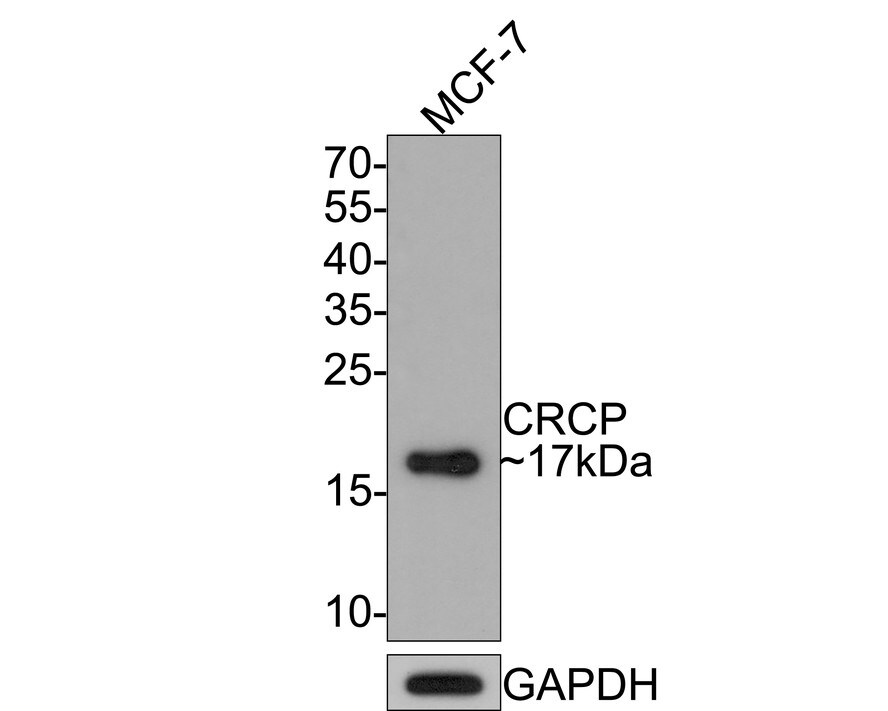 CRCP Antibody (JE65-42) Western Blot: CRCP Antibody (JE65-42) [NBP3-32218]