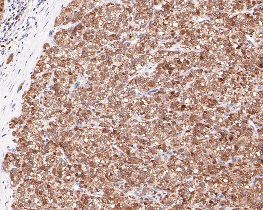 CRCP Antibody (JE65-42)
