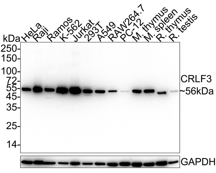 CRLF3 Antibody (PSH03-88) Western Blot: CRLF3 Antibody (PSH03-88) [NBP3-32223]