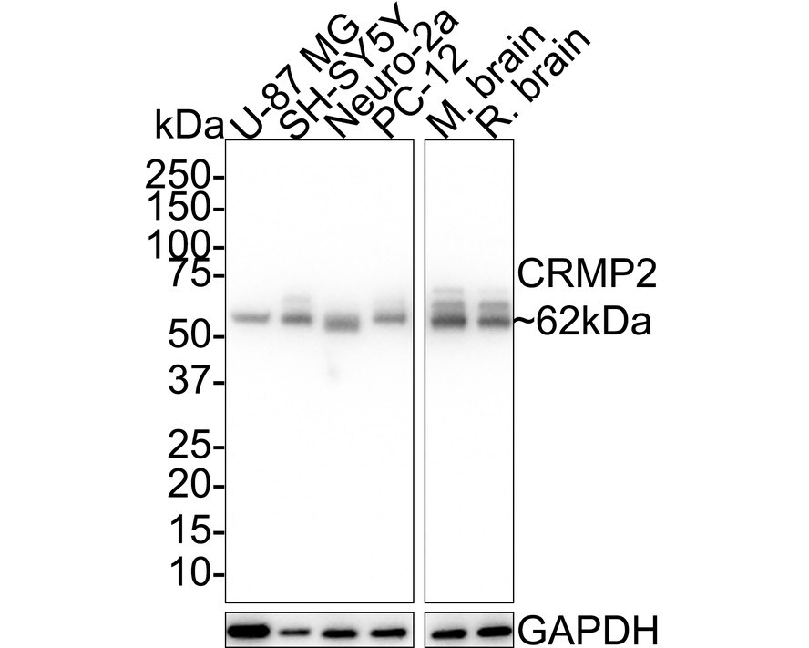 CRMP2 Antibody (JE31-53) Western Blot: CRMP2 Antibody (JE31-53) [NBP3-32224]