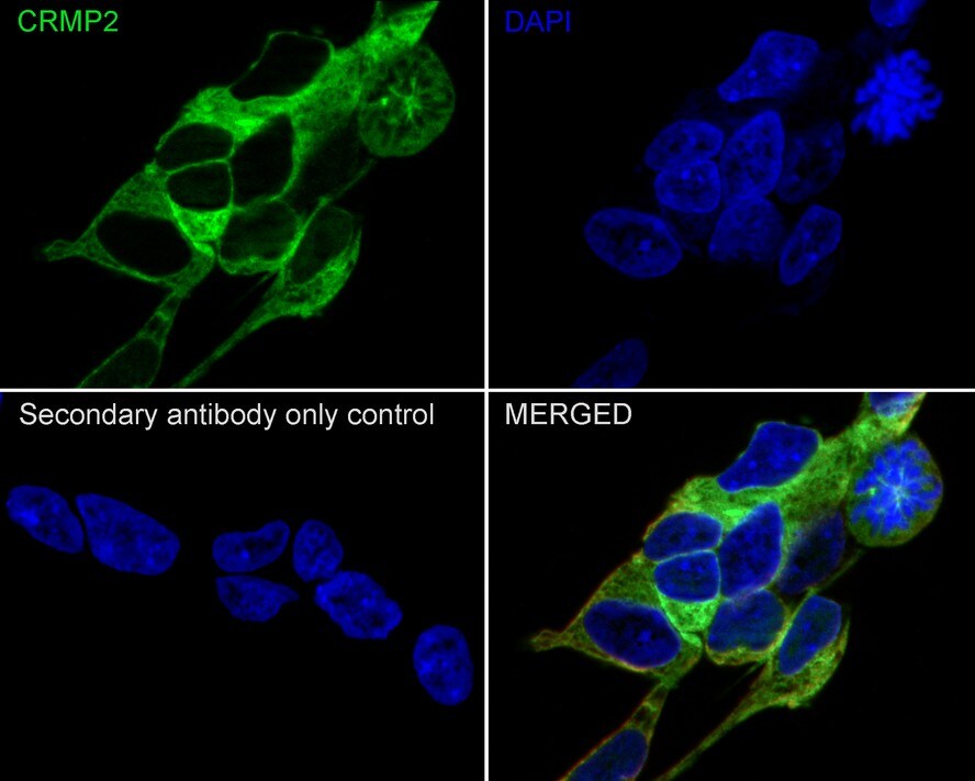 CRMP2 Antibody (JE31-53)