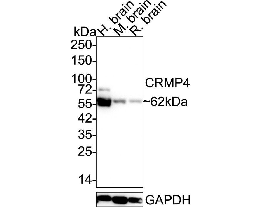 CRMP4 Antibody (JE55-99) Western Blot: CRMP4 Antibody (JE55-99) [NBP3-32225]