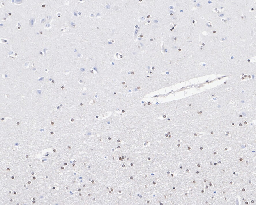 TORC3/CRTC3 Antibody (JE63-18)