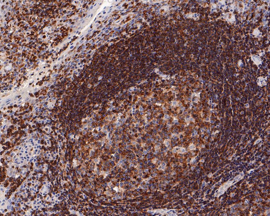 M-CSFR/CD115 Antibody (PD00-45)
