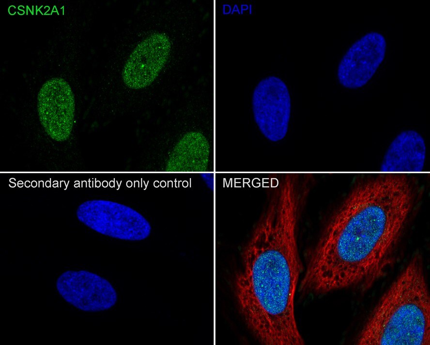 Casein Kinase 2 alpha Antibody (PSH04-54)