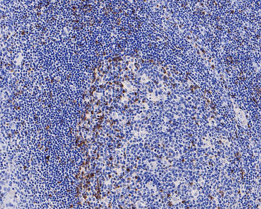 CTLA-4 Antibody (PS01-34)