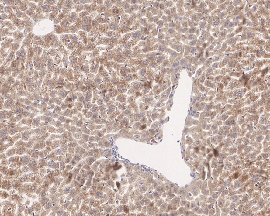 CTU2 Antibody (PSH04-05)