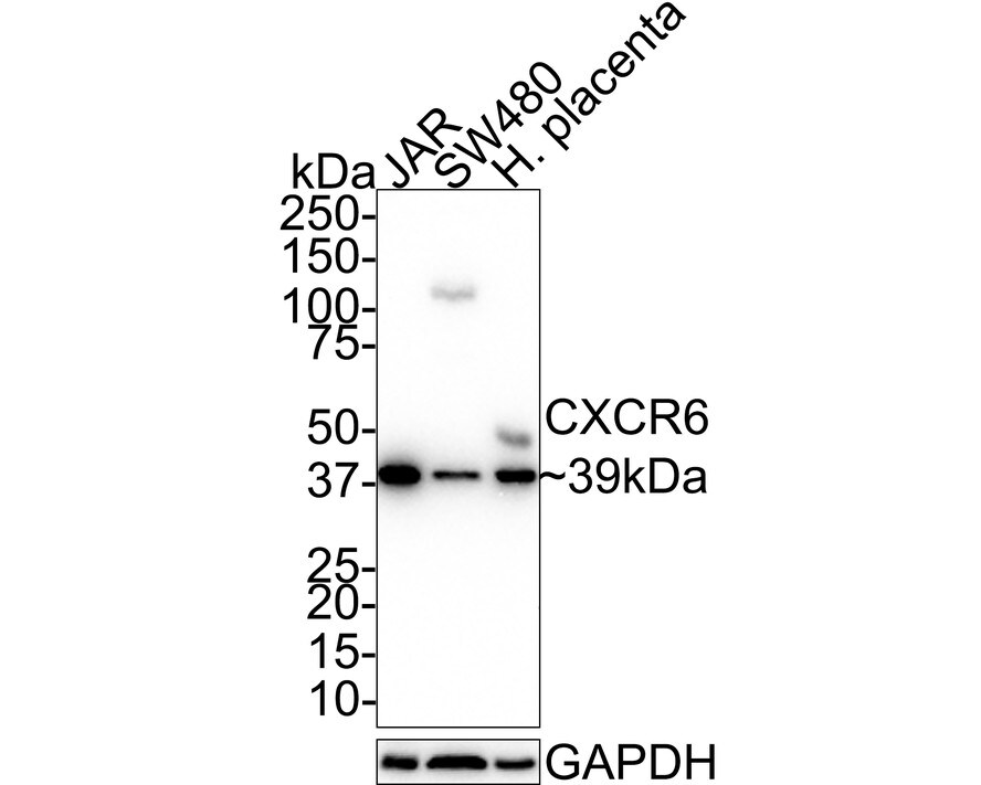 CXCR6 Antibody (JE66-40)