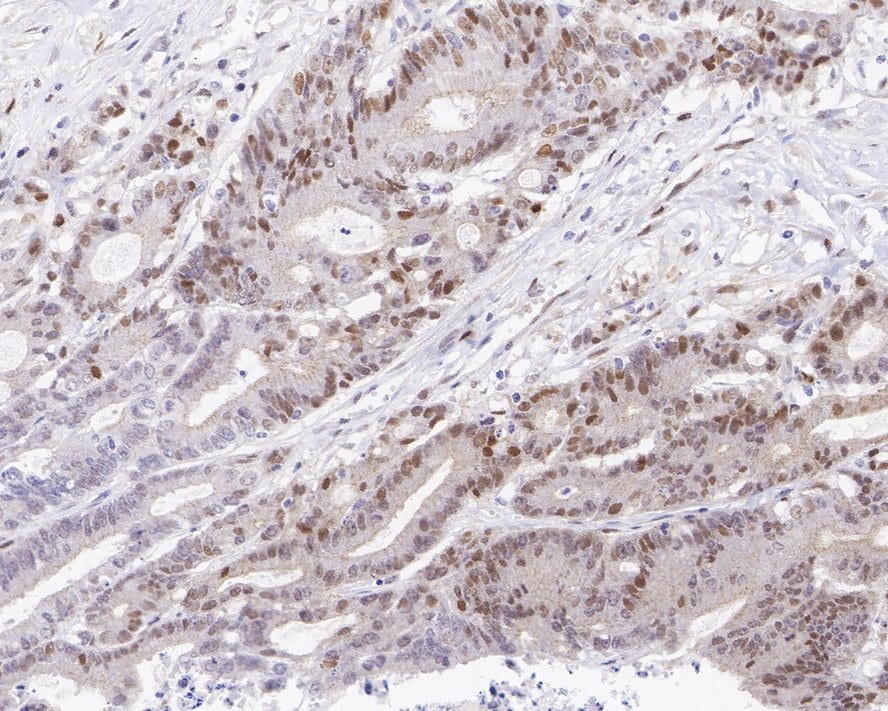 Cyclin D1 Antibody (PD01-64)