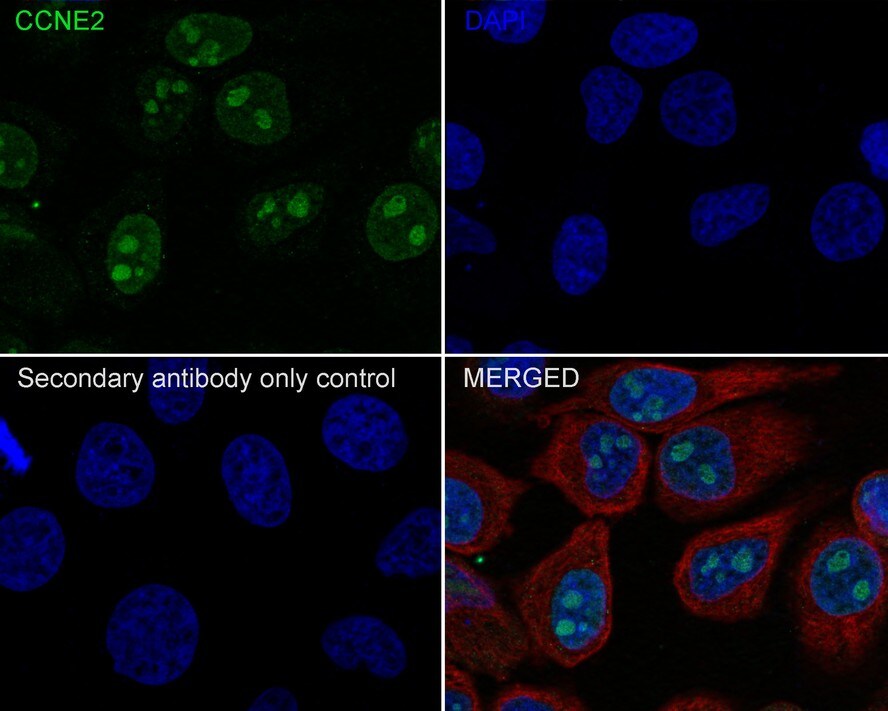 Cyclin E2 Antibody (40-89-R)