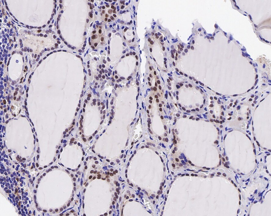 Cyclin E2 Antibody (40-89-R)