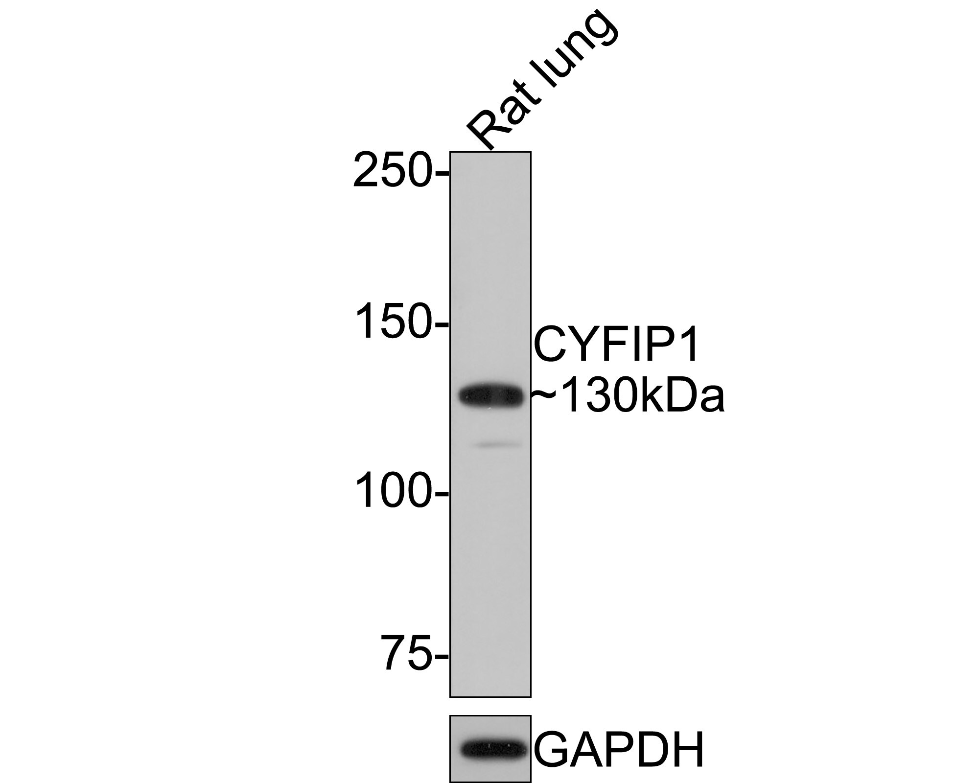 CYFIP1 Antibody (JE64-11) Western Blot: CYFIP1 Antibody (JE64-11) [NBP3-32239]
