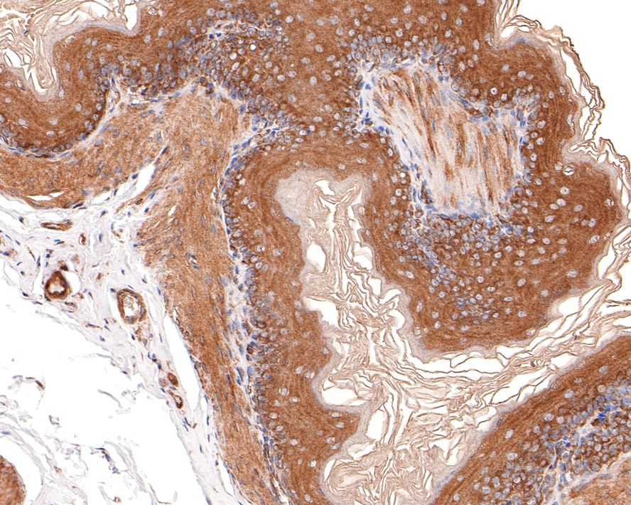CYFIP1 Antibody (JE64-11)
