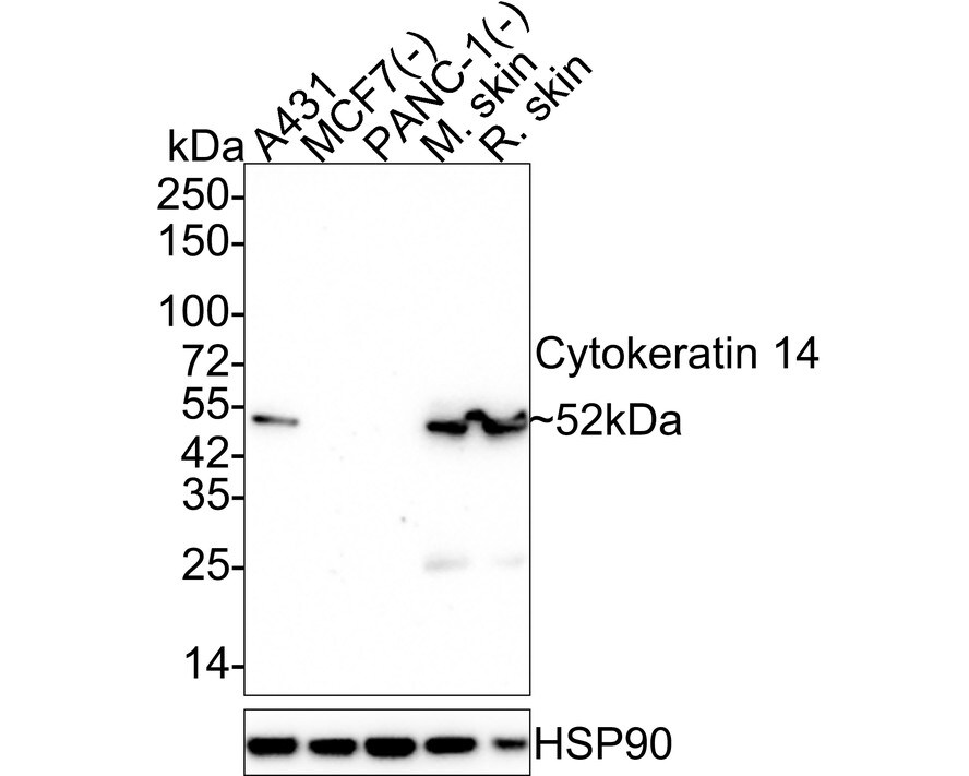 Cytokeratin 14 Antibody (A2C11-R) Western Blot: Cytokeratin 14 Antibody (A2C11-R) [NBP3-32242]