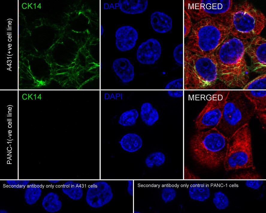 Cytokeratin 14 Antibody (A2C11-R)