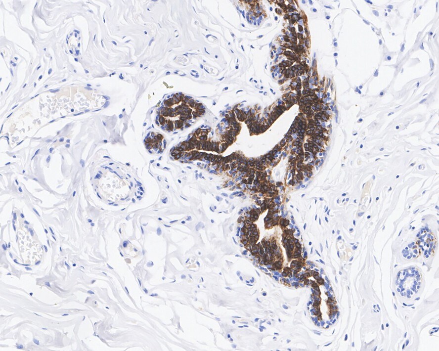 Cytokeratin 14 Antibody (A2C11-R)