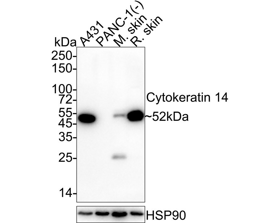 Cytokeratin 14 Antibody (A2C10-R) Western Blot: Cytokeratin 14 Antibody (A2C10-R) [NBP3-32243]