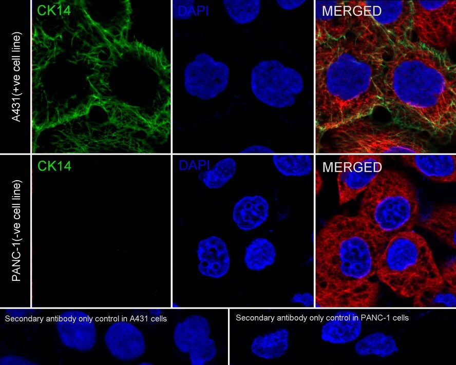 Cytokeratin 14 Antibody (A2C10-R)