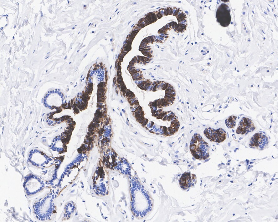 Cytokeratin 14 Antibody (A2C10-R)