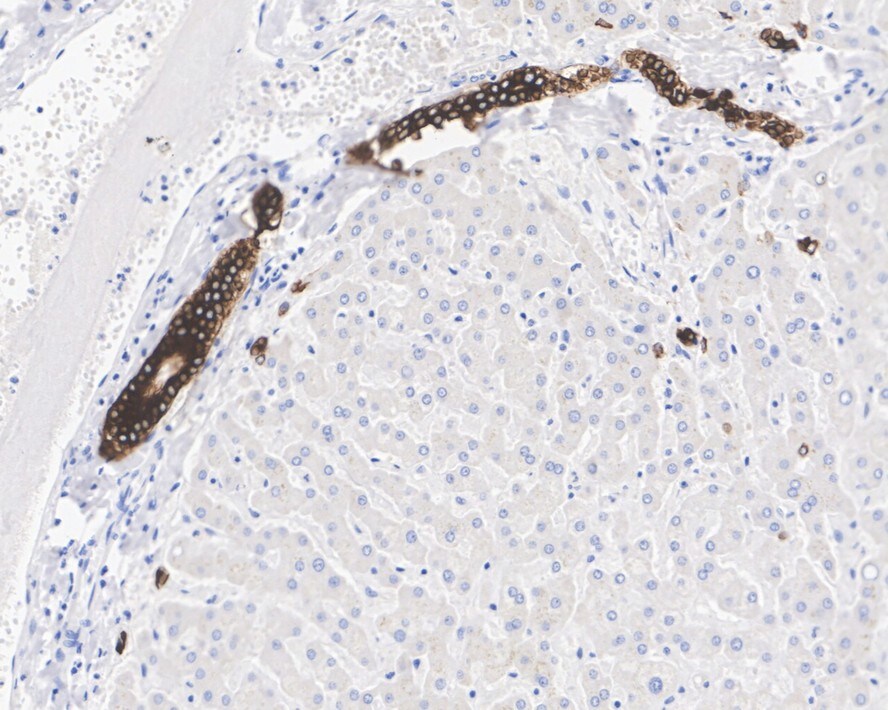 Cytokeratin 19 Antibody (A3D1-R)
