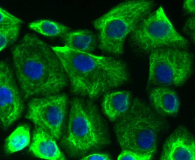 Cytokeratin 19 Antibody (SA30-06)