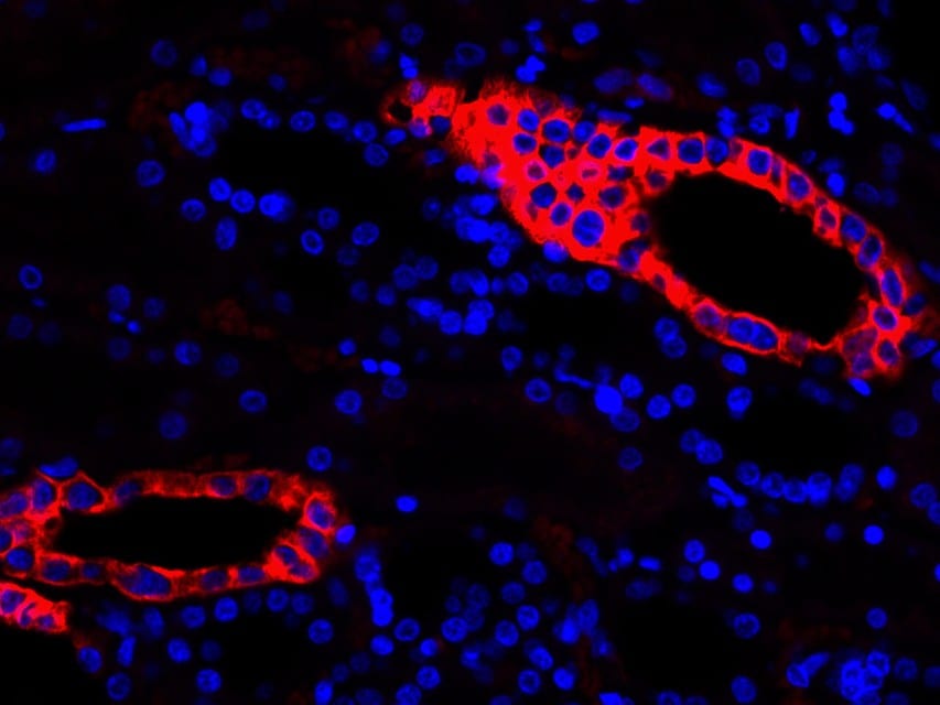 Cytokeratin 19 Antibody (SA30-06)