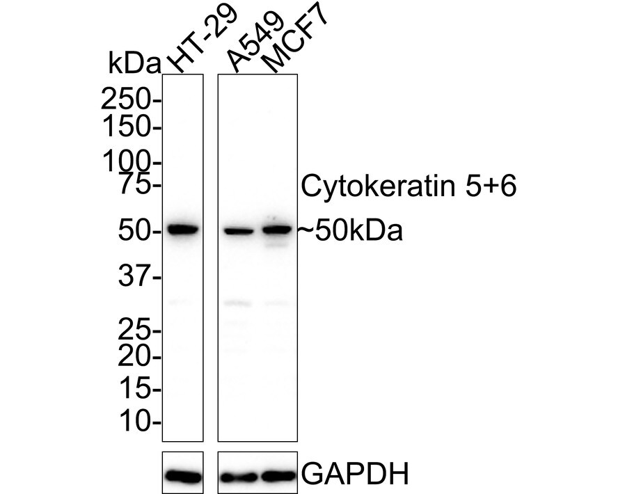 Cytokeratin 5/6 Antibody (A2B2-R) Western Blot: Cytokeratin 5/6 Antibody (A2B2-R) [NBP3-32250]
