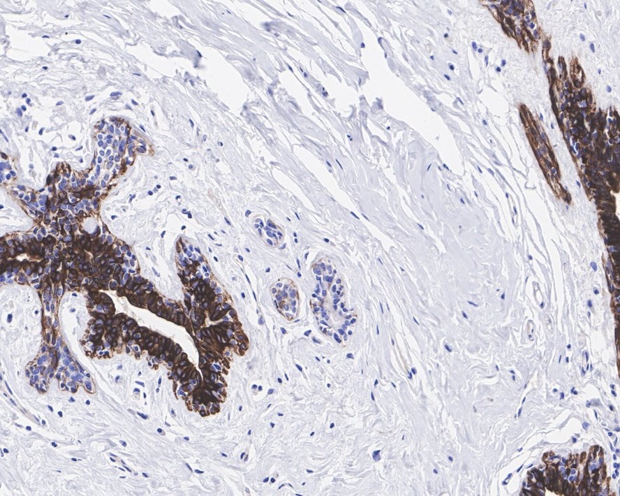 Cytokeratin 5/6 Antibody (PSH0-67)