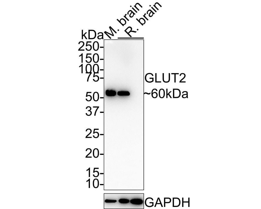 Cytokeratin 5/6 Antibody (PSH0-68) Western Blot: Cytokeratin 5/6 Antibody (PSH0-68) [NBP3-32252]