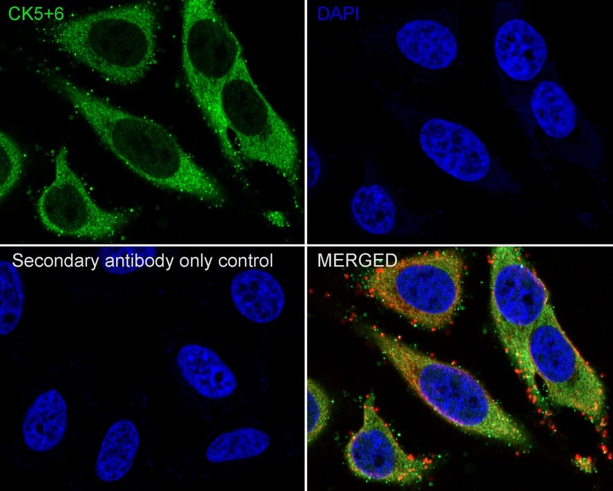 Cytokeratin 5/6 Antibody (PSH0-68)